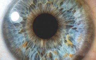 Iridology