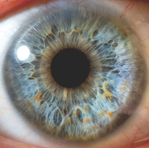 Iridology